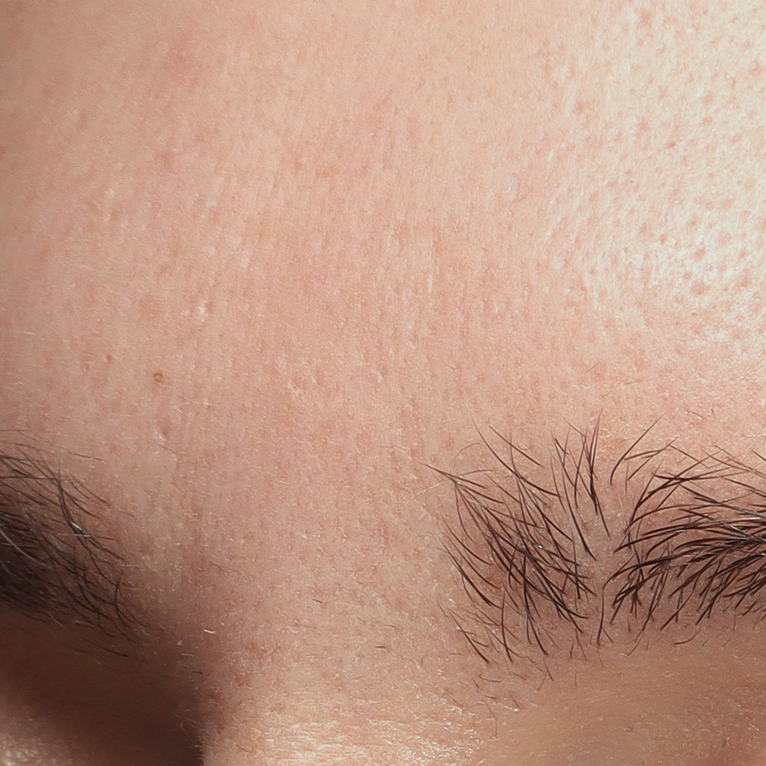 FACETOX - Pt 3 - AFTER