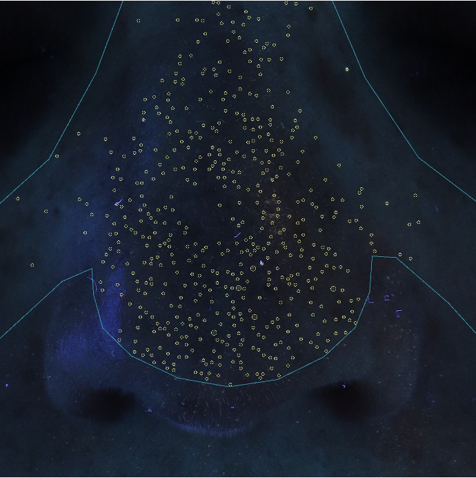 Nosetox porfyrines voor behandeling met botuline toxine