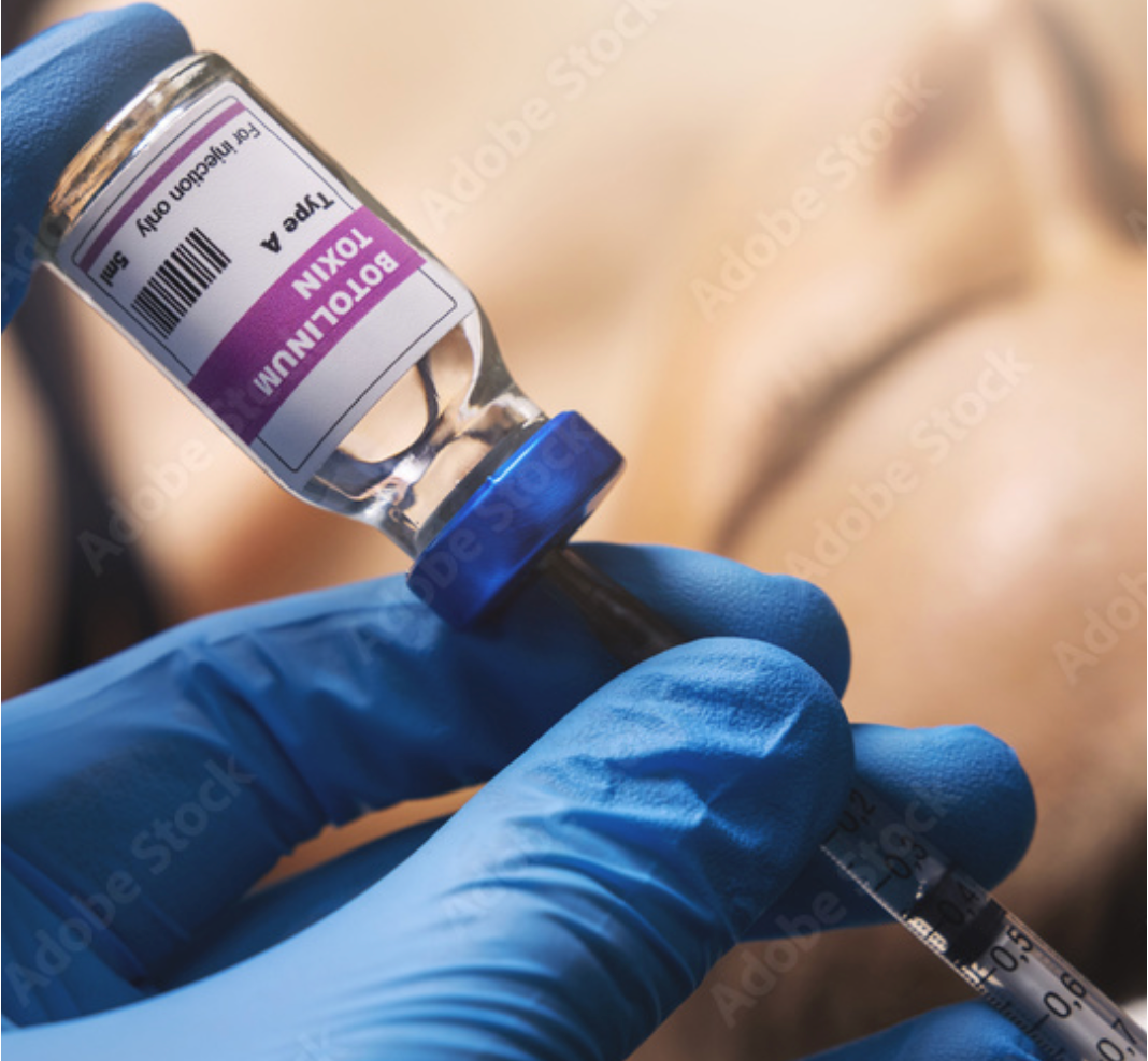 Botulinetoxine injecties